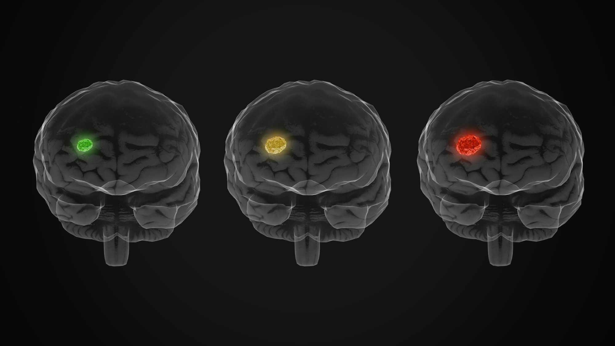 brain activity during dreams involving memory and emotion