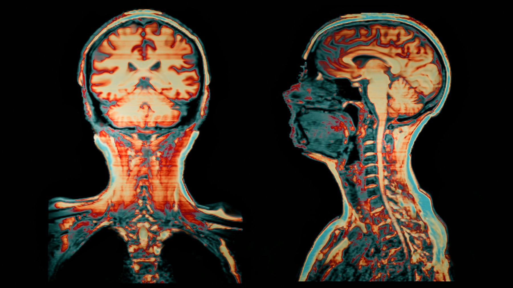 neurotransmitters and hormones comparison for body communication