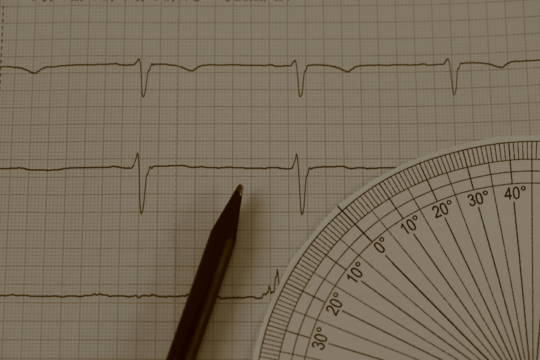 heart rate graph showing different nighttime heart patterns