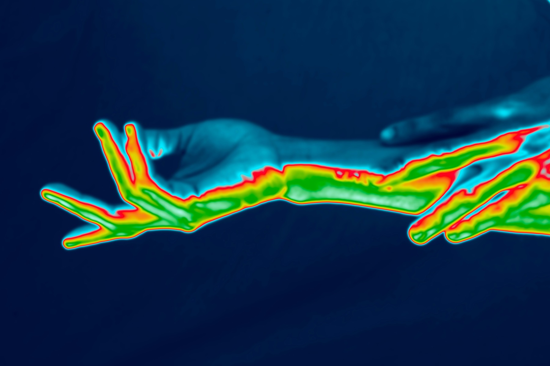 Thermal image showing skin temperature differences in the hands and arms.