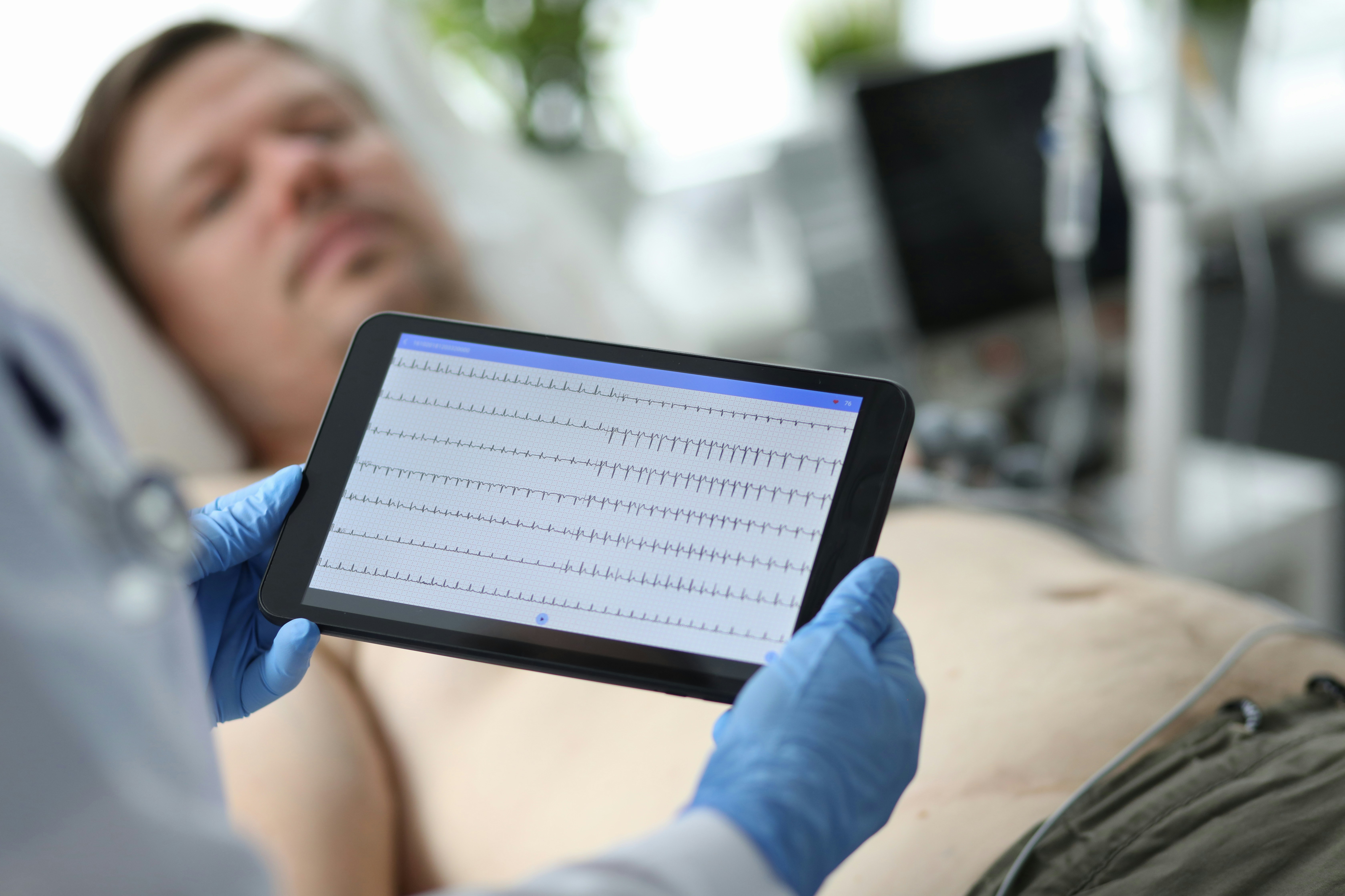 sleeping heart rate pattern shown on a heart monitor